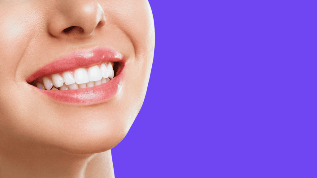 מדוע יישור שיניים הוא שלב הכרחי לפני הלבנת שיניים 3